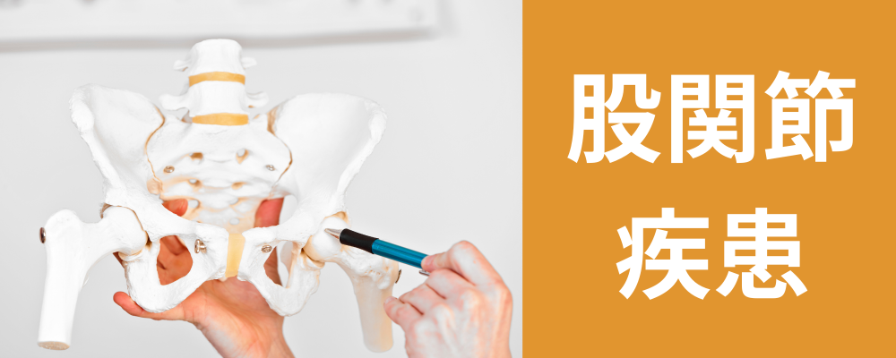 股関節 疾患